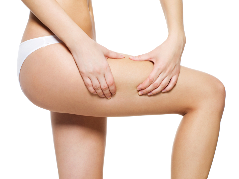 How to Get Rid of Cellulite