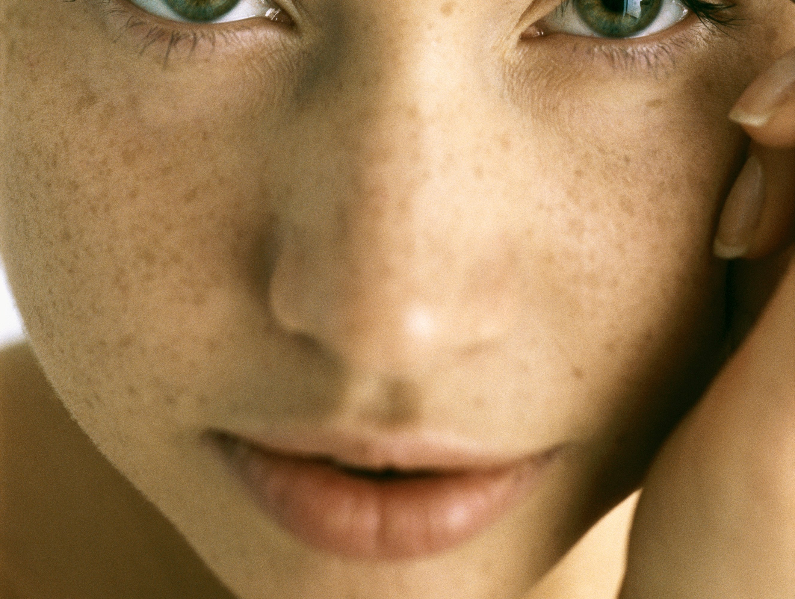 How to Banish Embarrassing Peach Fuzz