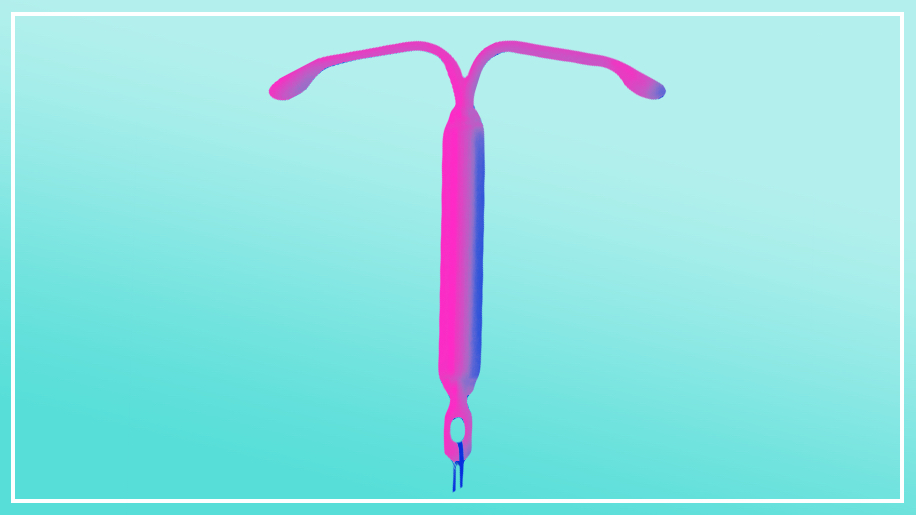 iud review mirena