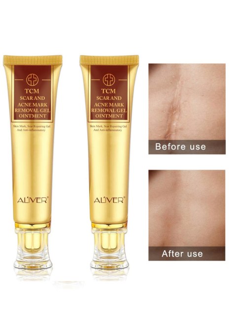 acne-scar-products-aliver