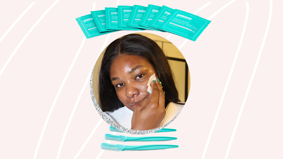 chemical peel at home review